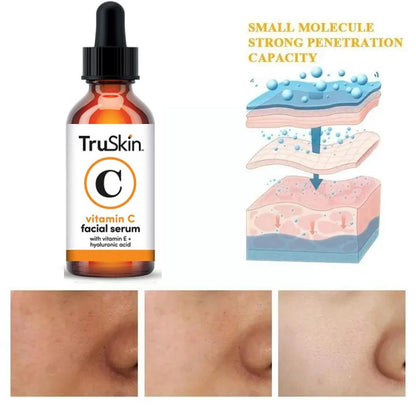 Face Serum TruSkin Vitamin C With Hyaluronic Acid